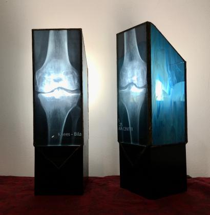 Knee X-ray ligths